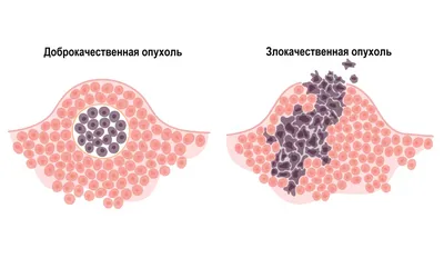 Укусы насекомых у детей: профилактика и лечение | Клиника Рассвет