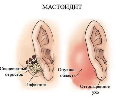 Онколог рассказал об опасности \"шишки\" под кожей: Лучше не задевать -  Российская газета