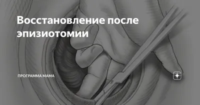 Нина Зайченко - MilkBlogger - Почему происходят разрывы промежности во  время родов? Зачем делают рассечение промежности в родах? Какие показания  для эпизиотомии? Как не порваться в родах? Как подготовить промежность к  родам?