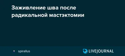 Увеличение груди (Маммопластика) в Ростове-на-Дону