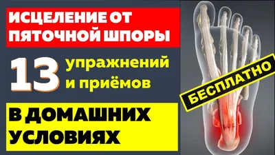 Отзыв о Лечение пяточной шпоры | Вылечить пяточную шпору - легко!