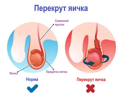 У ребёнка сильно сухая кожа, покраснения на животике, в паху - Вопрос  дерматологу - 03 Онлайн