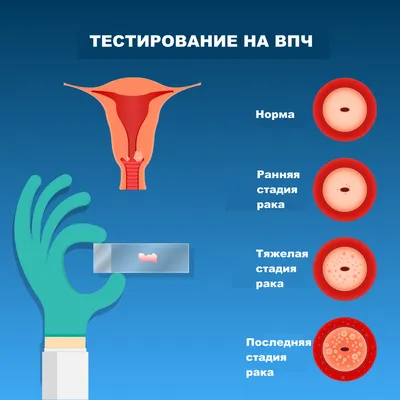 Я узнала, что ВИЧ-инфицирована, когда была беременна» — разговор с Верой  Варыгой