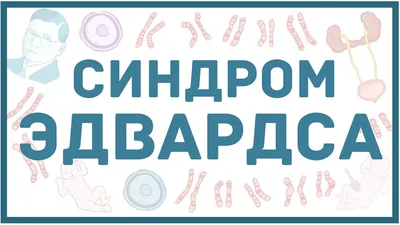 Только молока прибавилось, как Тата от нас ушла». Мама ребенка с синдромом  Эдвардса – о любви и потере | Правмир