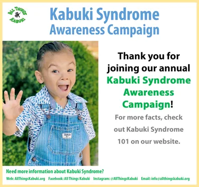 File:Kabuki Syndrome 7.jpg - Wikipedia