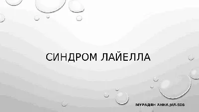 Синдром Стивенса-Джонсона и синдром Лайелла у взрослых (Лысенко М.А.,Фомина  Д.С.,Проценко Д.Н.и др.) ГЭОТАР-Медиа (ISBN 978-5-9704-7663-5) купить от  731 руб в Старом Осколе, сравнить цены - SKU12279500