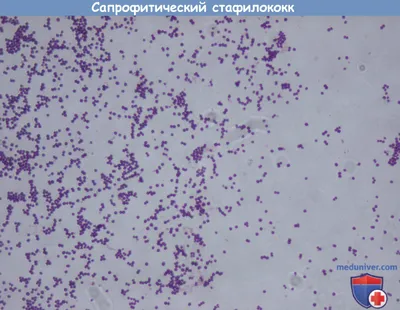 Болезнь Аддисона, витилиго, синдром Лайелла и еще 5 заболеваний, о которых  говорит наша кожа | Больше, чем училка | Дзен