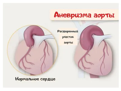 Как в Корее диагностировали редкую генетическую болезнь • Medmost