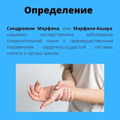 Научно-Диагностический центр Immunogen test - Синдром Марфана – это  врожденная патология соединительных тканей. Обусловлена болезнь нарушениями  процесса продуцирования фибриллина – белка, обеспечивающего сокращение и  эластичность соединительных тканей ...