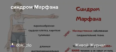 Болезнь (синдром) Марфана: что нужно знать?! Marfan disease. - YouTube