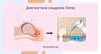 Особенности ДНК-тестирования при выявлении генетических патологий на ранних  сроках беременности в Волжске на СКИДКОМ.РФ