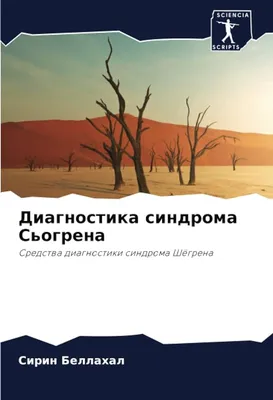 02-05 Ревматические болезни. Ревматоидный артрит. Синдром Шегрена.  Системная склеродермия. - YouTube