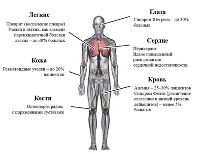 Синдром Шегрена: что это, причины, симптомы и лечение болезни