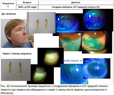 Лечение синдрома Шегрена в Клинике СЛ (улица Павлюхина, Казань)