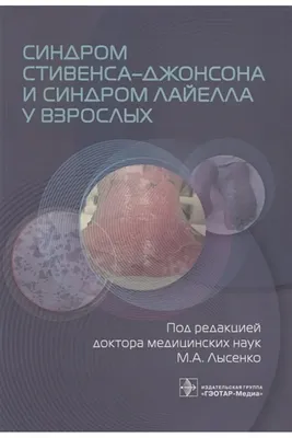 Синдром Стивенса–Джонсона и синдром Лайелла у взрослых • Лысенко М.А. и  др., купить по низкой цене, читать отзывы в Topar.uz • Эксмо-АСТ • ISBN  978-5-9704-7663-5