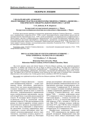 Синдром Стивенса-Джонсона и синдром Лайелла: этиология, патогенез, клиника,  диагностика, лечение | Медицинский Ресурсор