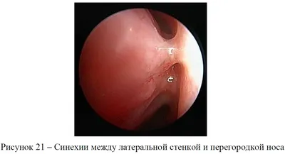 Dr. Marina Bezhanidze - Полипы,синехии. Чего не должно быть в полости  матки?❌ Матка состоит их 3-х слоев: серозный слой или наружный, средний  слой – мышечный и внутренний – эндометрий. Поговорим сегодня подробнее