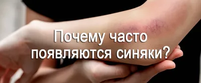 Названы причины внезапного появления синяков: Уход за собой: Забота о себе:  Lenta.ru