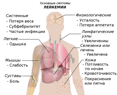 Почему на теле могут появляться синяки без причин? | ВКонтакте