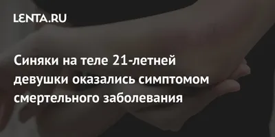 Синяки при лейкозе: как выглядят, чем отличаются от обычных, как распознать  симптом у детей — Инфоцентр Детский Лейкоз