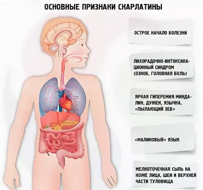 Корь, краснуха, скарлатина.