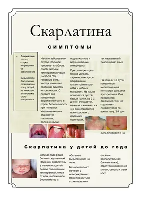 Скарлатина