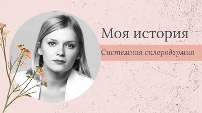 Склеродермия: причины, симптомы и признаки, диагностика и лечение в Москве