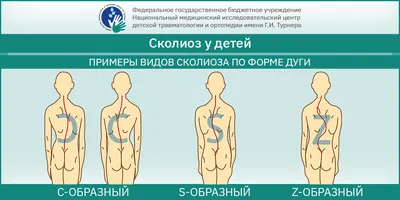 Анатомия - СКОЛИОЗ. 2 СТЕПЕНЬ 16 ГРАДУСОВ Тренировки с... | Facebook