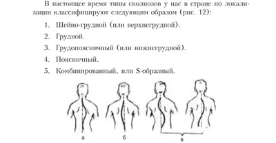 Берут ли со сколиозом в МВД и ФСБ? | Протезно-ортопедический центр | Дзен