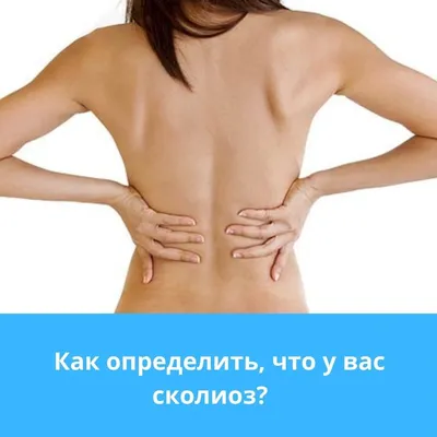 Сколиоз: этиология, классификация, диагностика, лечение - Vertebra