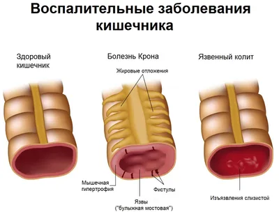 Сколько кала нужно для анализа фото