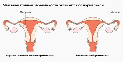 Менструация - виды выделений, объем, норма | Клиника МедПросвет