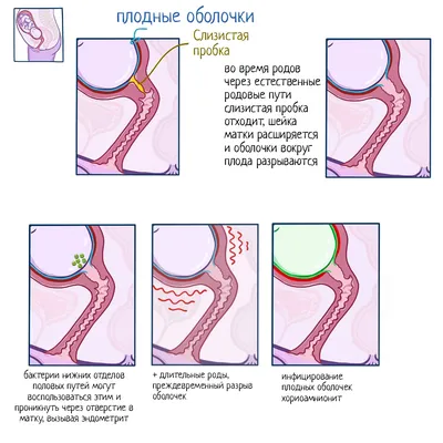 Когда отходит слизистая пробка у беременных перед родами? | Идеальная Я