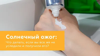 Солнечный ожог кожи: первая помощь, лечение, степени