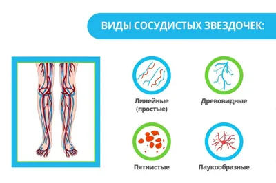 Удаление сосудистых звездочек в Москве – цена в ФНКЦ ФМБА России