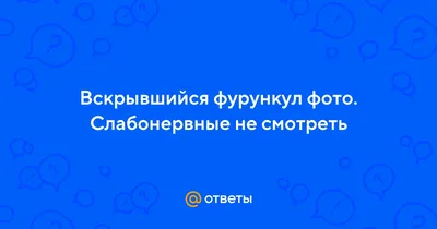 Фурункул: лекарства, используемые при лечении - МИС Аптека 9-1-1