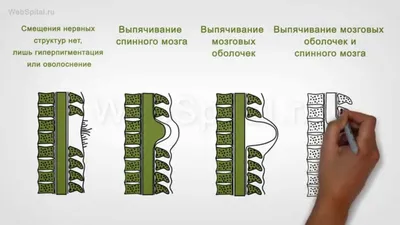 Диагноз не для этого города – Коммерсантъ