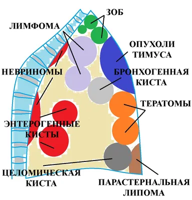 Топ ан средостения | PDF