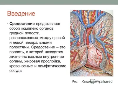 Комплексная лучевая диагностика при объемных образованиях средостения |  EasySchool