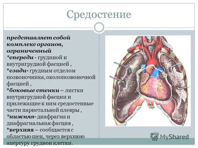 Неврологические проявления новообразований средостения