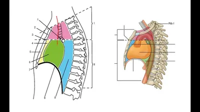 Средостение. Анатомия и наиболее частые патологии. — 24Radiology.ru