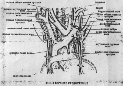 Хирургия. Средостение. Опухоль | Пикабу