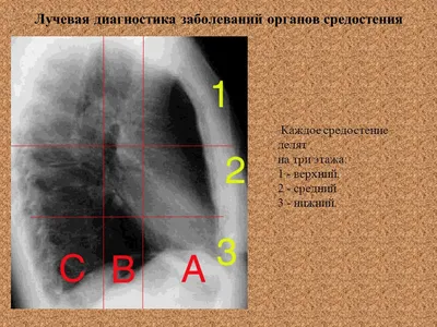 Топография органов средостения