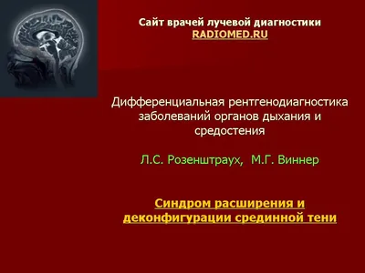 Опухоль средостения: симптомы, признаки, прогноз, диагностика, клинические  рекомендации и лечение рака средостения