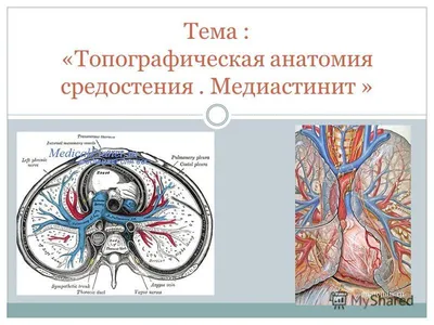 Основы. ОГК. Средостение. Опухоли средостения (Методические рекомендации).  + | Портал радиологов