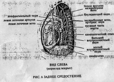 Основы. ОГК. Средостение. Синдром расширения и деконфигурации срединной  тени. + | Портал радиологов