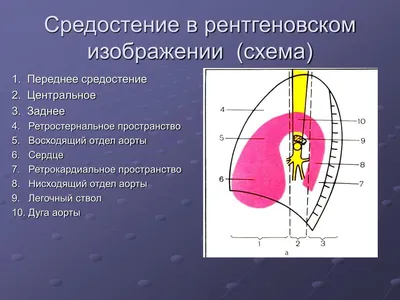 КТ-анатомия легких, средостения и сердца. Аксиальные срезы | e-Anatomy