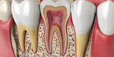 Лечение кариеса, пульпита, периодонтита