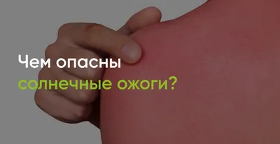 Чем опасны солнечные ожоги? - полезные статьи от специалистов - Медицинский  центр «АудиоМед»