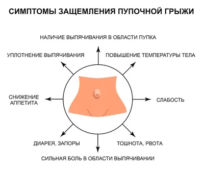 Елена Анатольевна Плетнева on Instagram: \"Самое главное в уходе за пупочной  ранкой — обеспечение свободной циркуляции воздуха. Это необходимо для того,  чтобы пуповинный остаток быстрее подсох, а ранка затянулась. Воздушные  ванны нужно